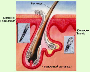 demodex2