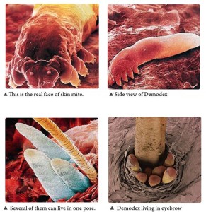 demodex_EN1