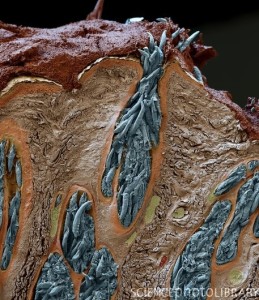 Eyelash mites, SEM